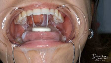 Spit production in my mourh