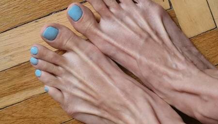 My veiny feet and spreading toes