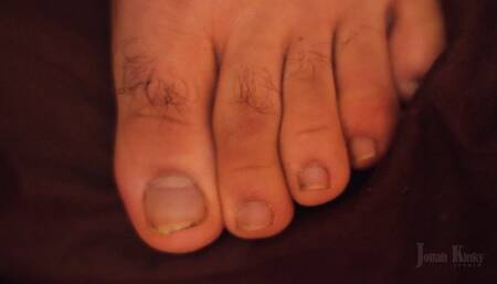 Cutting Dirty Toenails