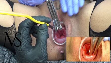 Extreme and strange deep with screws in the deep end of my uterus