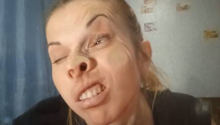 Crush my face with extreme brutality