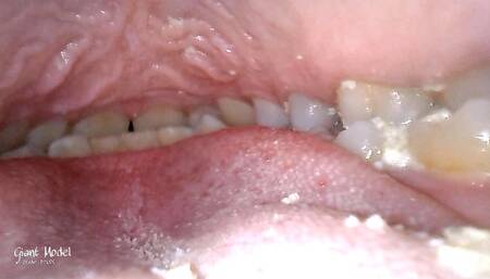 Inside a man's mouth during the lunch