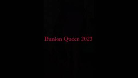 Elegant and sexy Bunions