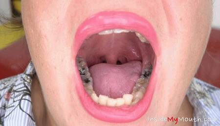 Inside My Mouth - Vanessa's mouth examination and exploration (MOBILE)