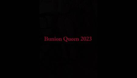 Bunions in high red heels