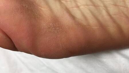 Bare feet close-up and detail