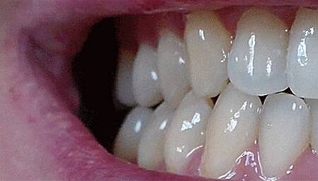 avi my teeth mouth lip