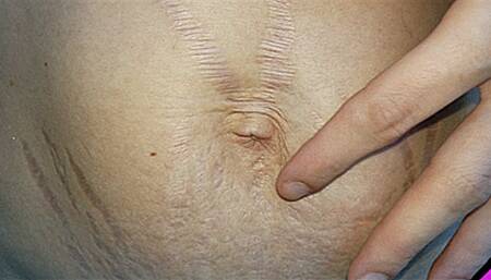 Showing Off My Belly Button With A Bad Case Of Hiccups (4K - UHD 2160p MP4)