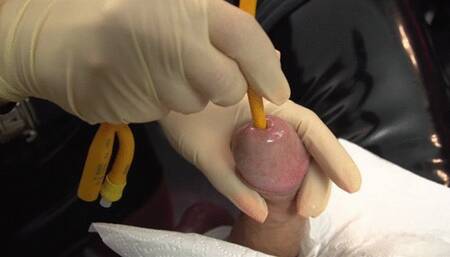 Another Foley Catheter Insertion (White Latex Gloves)