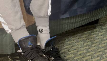 Mens feet with smelly bunions hammertoes and corns