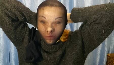 Extreme facial compression