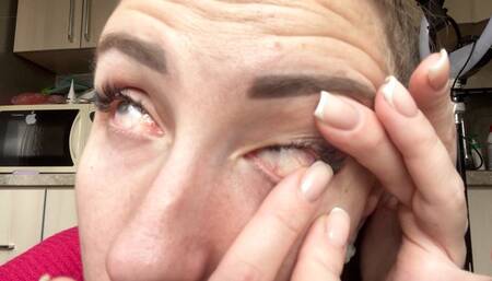 Trying to move the eyeball