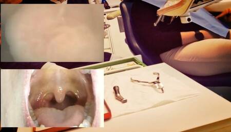 New Experiment - Dental Vore 720HD