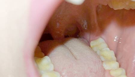 teeth tour -admire my teeth very close to the camera ---