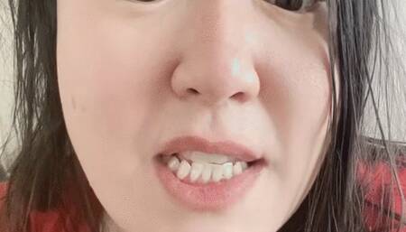 Talking about dental care