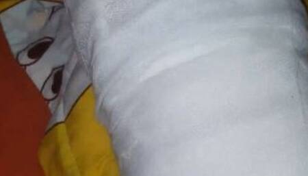 Wiggling my toes in cast