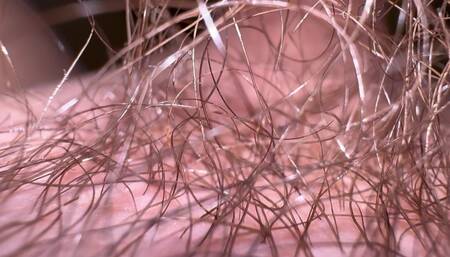 Macro Skin on My Dick