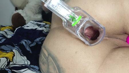 Speculum Two