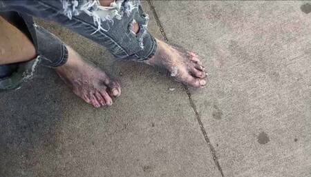 12-31-2023 Spit Feet Sunday