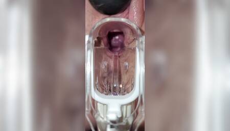 Speculum Cervix Orgasm Cumshot