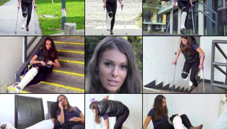 Lia SLC Soft Cast Crutching to Get a More Permanent Cast Applied (in HD 1920X1080)