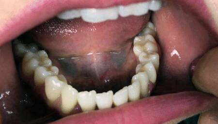 Tamara Teeth Tour And Bite - UHD 3840x2160 - 4K