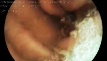 Medical exam in hospital video of medical endoscopy in full screen 480avi