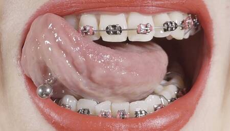 braces close-up with dirty talk (JOI)