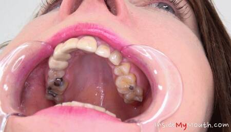 Inside My Mouth - Chanel Kiss - mouth examination and exploration part 2 (FULLHD)