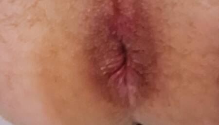 My Hole's on Fire.