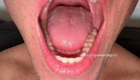 Andrew Mouth and Lower Teeth Part16 Video1 - MP4