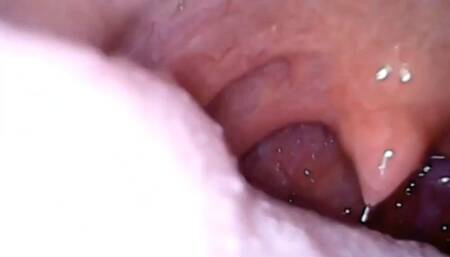 Digestion of Italian margherita pizza with lots of cheese - I swallow Pillcam Full screen exploration Vore 720HD