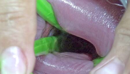 Cervix Dilatation | Stretching the Cervix with Sextoys