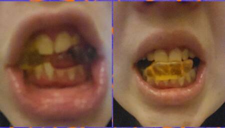 EXTREME close up Vore