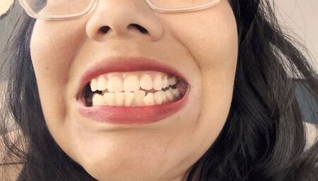 Teeth tour before deep cleaning