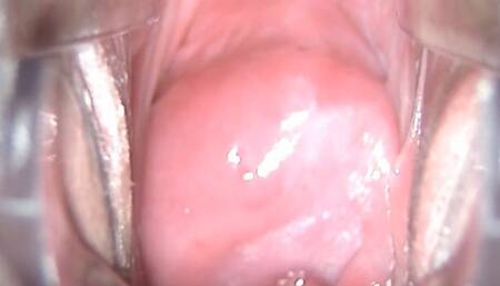 doctor role play, speculum in pussy , view inside pussy