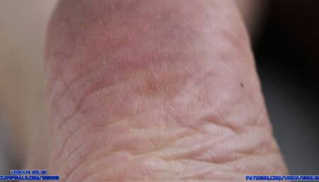 Exploring Frances' Soles