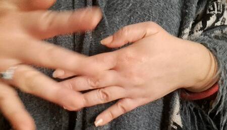 VEINS ON HANDS
