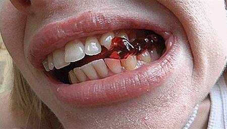 Sharp fangs chew bears! MP4