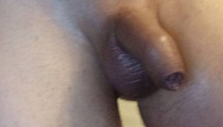 Anal..