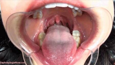 * 854x480p * Cheek Retractor Tongue Tease -Mov