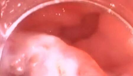 Eating Digesting Basmati Rice - Extreme Vore Exploration 4K