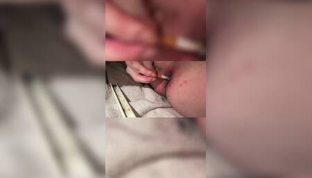 Asshole with Cigarettes