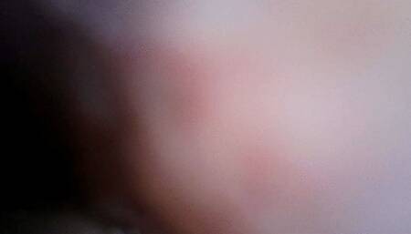 noodles inside stomach endoscope