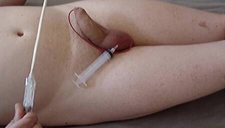 Cum Extraction