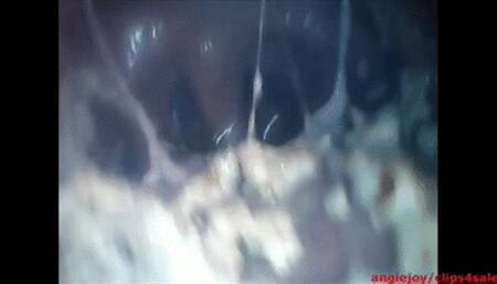 Endoscopy while crushing food wmv