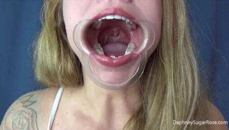 Cheek Retractor Spreading My Mouth Open Wide -Mov 1920x1080p