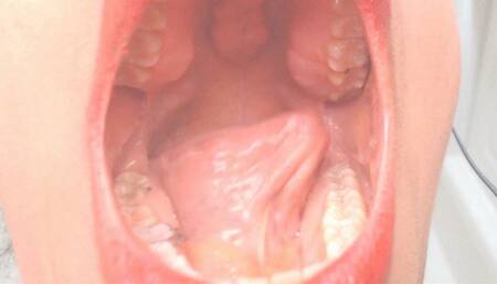 A Look Into My Mouth