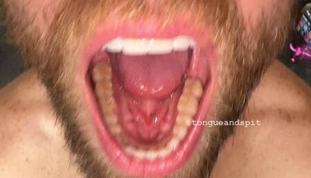Andrew Teeth Bottom Molars and Retainer Part17 Video1 - MP4