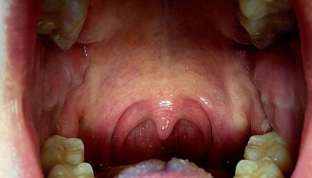 The Sounds of Digestion